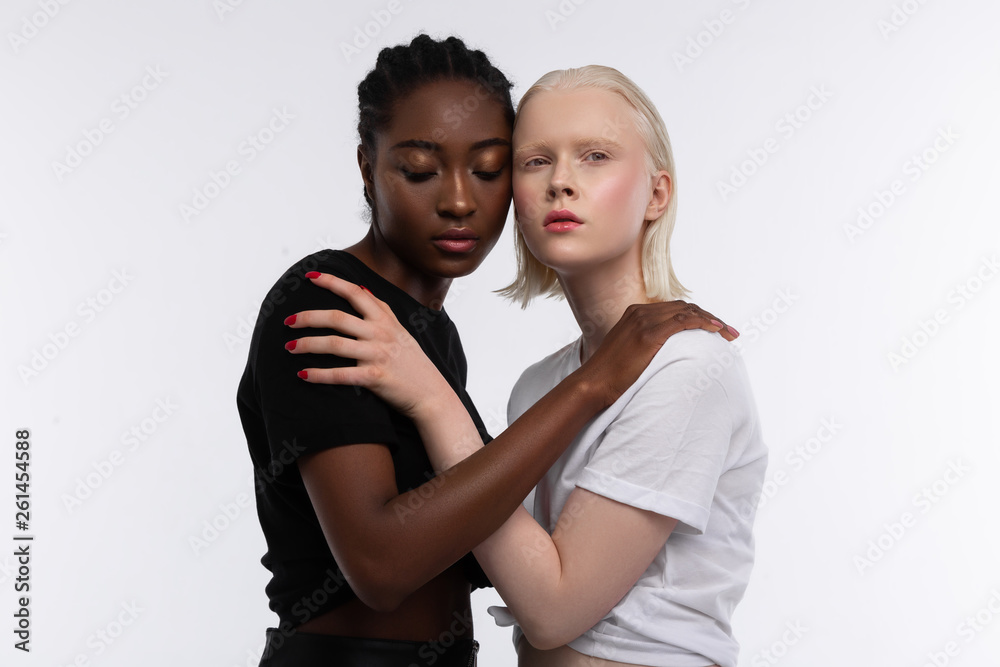 Obraz premium Woman with white skin touching shoulder of her African-American friend