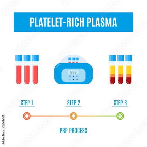 PRP procedure vector infographics with test tubes filled with blood before and after separation of platelets in the centrifuge. Platelet-rich plasma laboratory equipment. Regenerative medicine concept