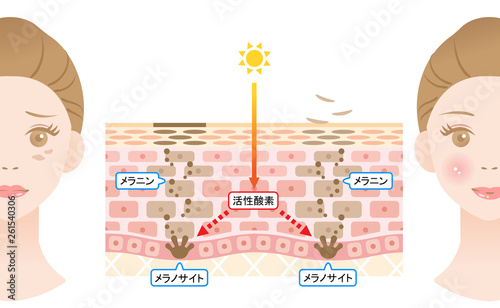 ターンオーバー　肌の断面図と女性
