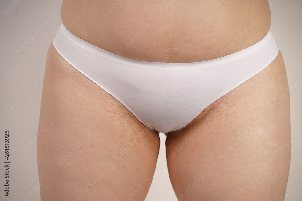 Foto de plus size overweight woman with stretches marks on her skin and a  hairy crotch standing in white sporty lingerie. female thick hips closeup.  unkempt plump girl. do Stock