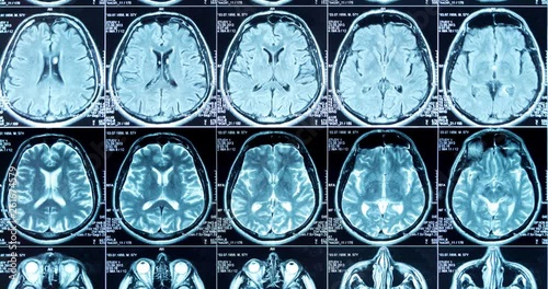 MRI scan of the brain close up, looped
