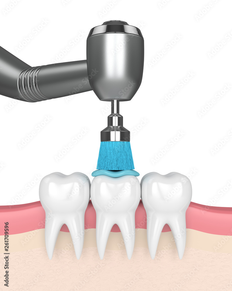 3d render of teeth with dental handpiece and polishing brush 3d render of teeth with dental handpiece and polishing brush