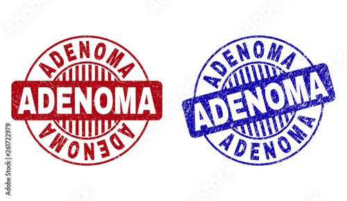 Grunge ADENOMA round stamp seals isolated on a white background. Round seals with grunge texture in red and blue colors. Vector rubber imprint of ADENOMA caption inside circle form with stripes.