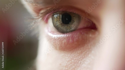 Eye irritated by onions and crying, closeup macro white male
