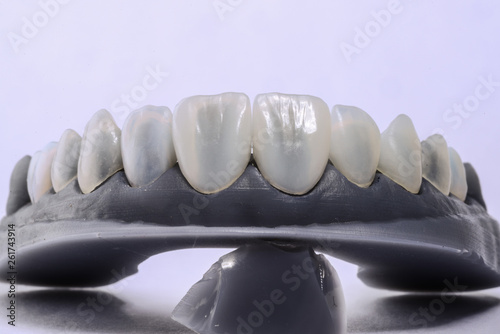 Close up of a dental model with veneers mounted on with dental tools isolated.