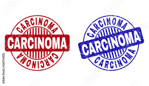 Grunge CARCINOMA round stamp seals isolated on a white background. Round seals with grunge texture in red and blue colors. Vector rubber overlay of CARCINOMA label inside circle form with stripes.