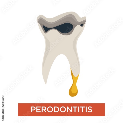 Periodontitis ill tooth dentistry mouth cavity disease