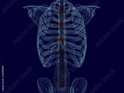 Wireframe of the chest and spine of a man of blue lines on a dark background. Red inflammatory areas along the spine. 3D. Vector illustration