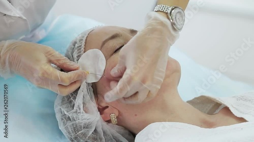 Cosmetician in gloves making face lifting injection to area around eyes. female client gets facial beauty procedure in healthcare clinic. liquid thread injection. Botox. collagen