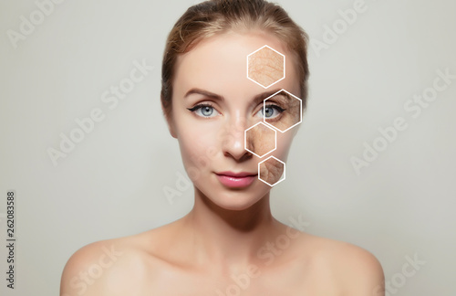 woman face portrait with problem old skin photo
