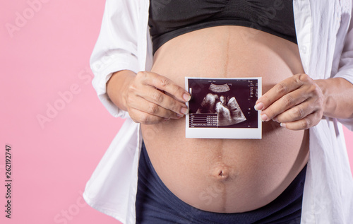 Close up of a cute pregnant belly and x-ray ultrasound scan of baby. Pregnant female motherhood concept. Side view, pregnant belly body part. Third trimester on pink background