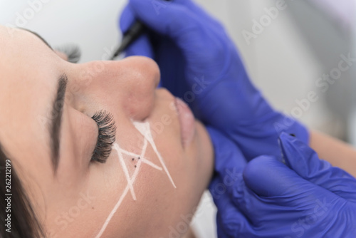 Doctor preparing female patient