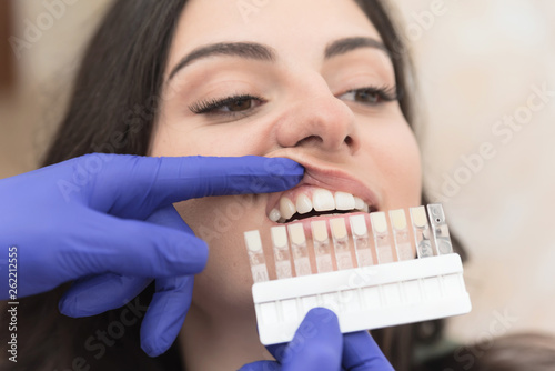 Teeth whitening at dental office
