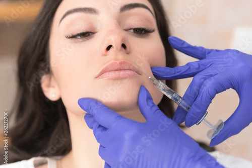 Woman having upperlip filler