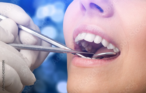 Woman teeth and a dentist mouth mirror