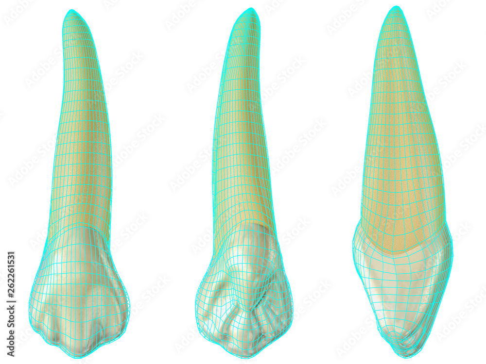 maxillary canine tooth in the vestibular, palatal and lateral views