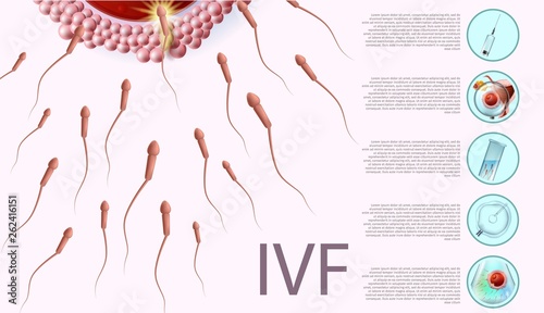In Vitro Fertilization Informational List, Banner