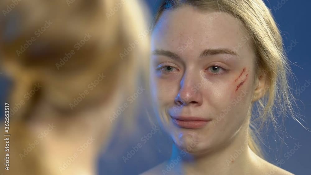 Teen girl with wounded face looking at mirror reflection and deeply crying Teen girl with wounded face looking at mirror reflection and deeply crying