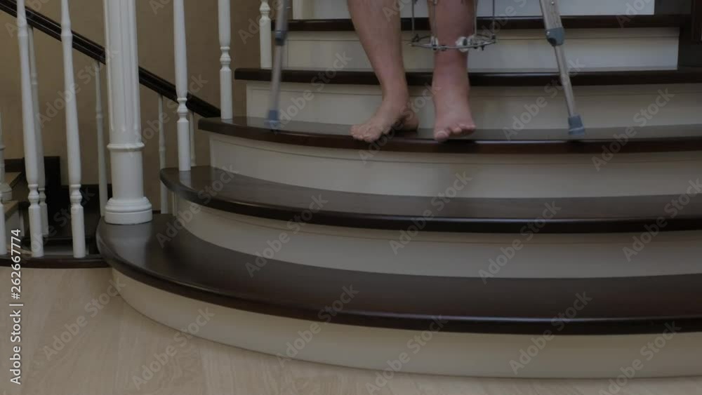 Descend the stairs on crutches with a broken leg in an external Ilizarov fixative. Closeup