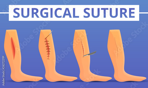 Medical suture concept background. Cartoon illustration of medical suture vector concept background for web design