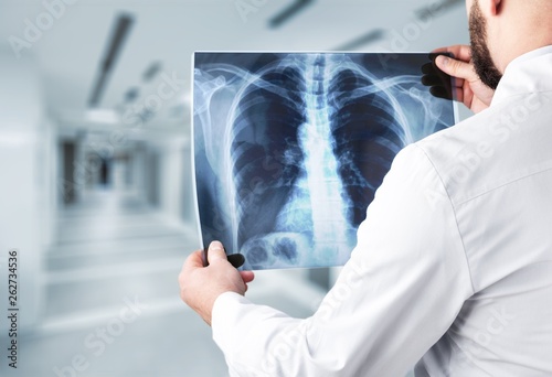 Young man doctor holding x-ray photo