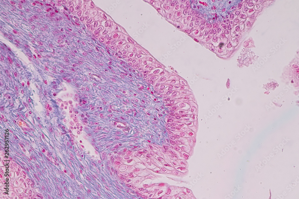 Education anatomy and physiology of Tongue under the microscopic in laboratory. Stock Photo