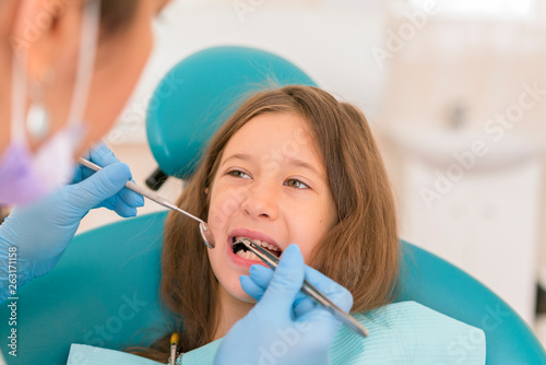 Macro close up of young child with open mouth at dentist. Teeth checkup at dentist s office. Dentist examining girls teeth in the dentists chair