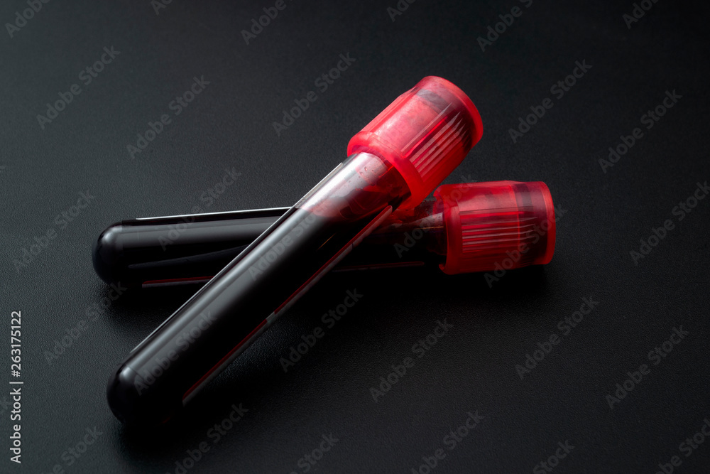 Phlebotomy, biochemical analysis, laboratory exam and blood testing concept theme with two test tubes isolated on black background Phlebotomy, biochemical analysis, laboratory exam and blood testing concept theme with two test tubes isolated on black background
