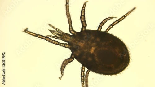 mite Hypoaspis under a microscope, from the order Mesostigmata, lives in the soil, is a predator 4K photo