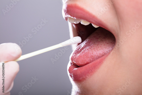 Dentist's Hand Taking Saliva Test From Woman's Mouth photo