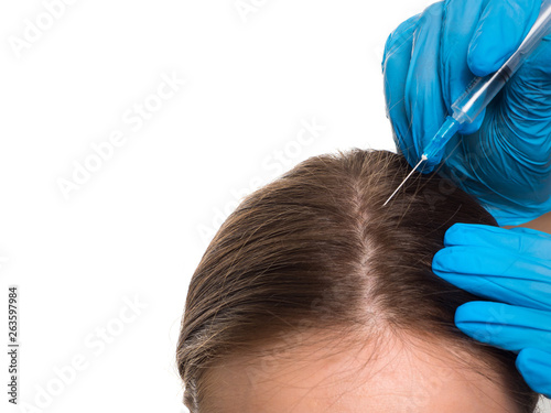 Hair loss problem. Woman with hair loss problem receiving injection, close up