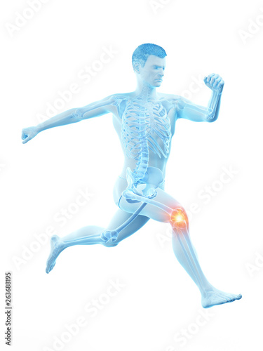 3d rendered medically accurate illustration of a runners painful kee © Sebastian Kaulitzki