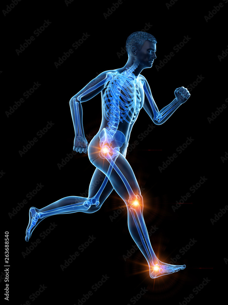 3d rendered medically accurate illustration of a runners painful joints