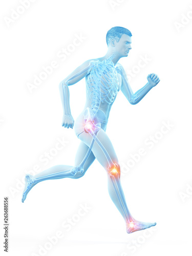 3d rendered medically accurate illustration of a runners painful joints