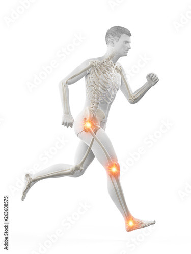 3d rendered medically accurate illustration of a runners painful joints