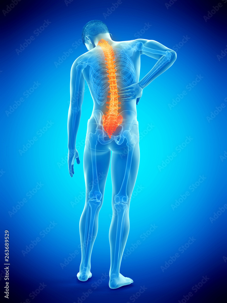 3d rendered medically accurate illustration of a mans painful back 3d rendered medically accurate illustration of a mans painful back