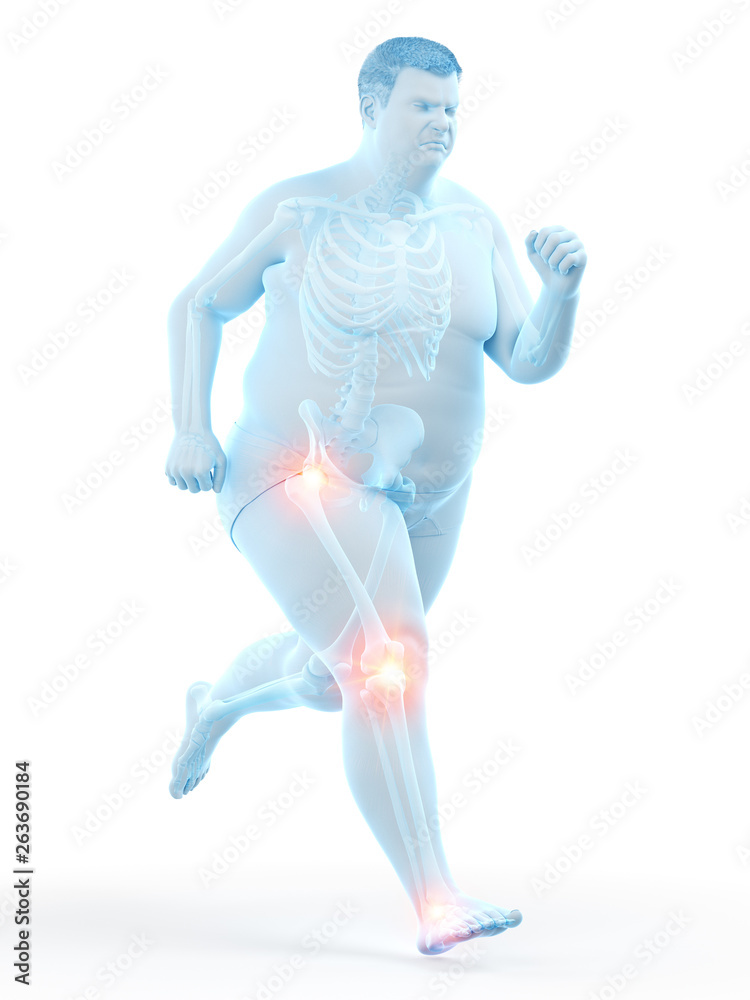 3d rendered medically accurate illustration of an obese runners painful joints 3d rendered medically accurate illustration of an obese runners painful joints