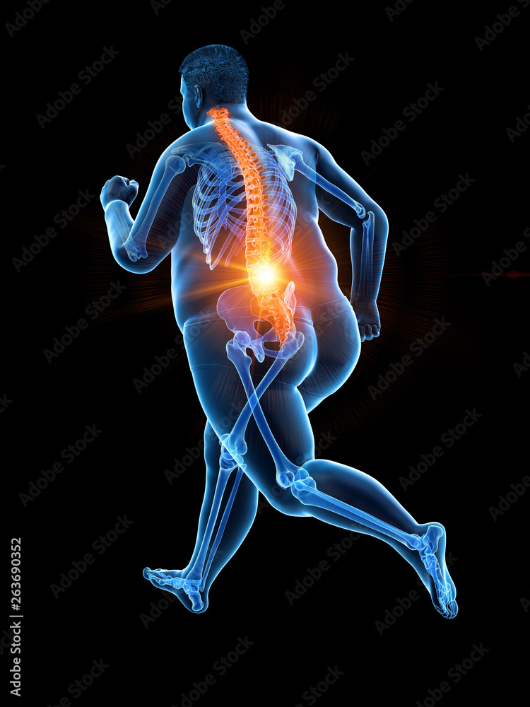 3d rendered medically accurate illustration of an obese runners painful back