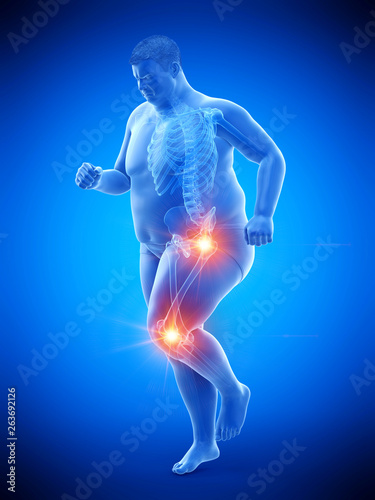 3d rendered medically accurate illustration of an obese runners painful joints