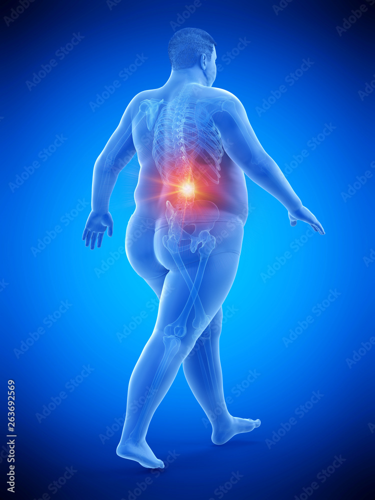Obraz premium 3d rendered medically accurate illustration of an obese runners painful back