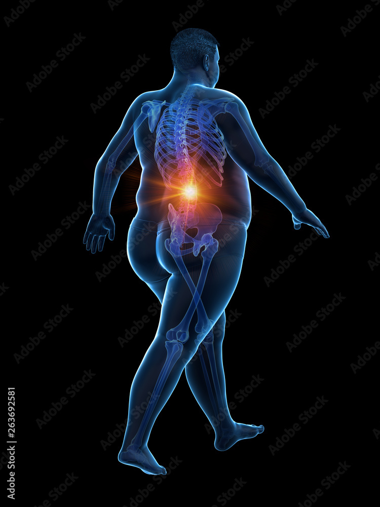 3d rendered medically accurate illustration of an obese runners painful back 3d rendered medically accurate illustration of an obese runners painful back