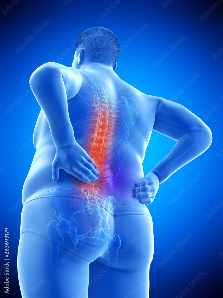 3d rendered medically accurate illustration of an obese mans painful back 3d rendered medically accurate illustration of an obese mans painful back