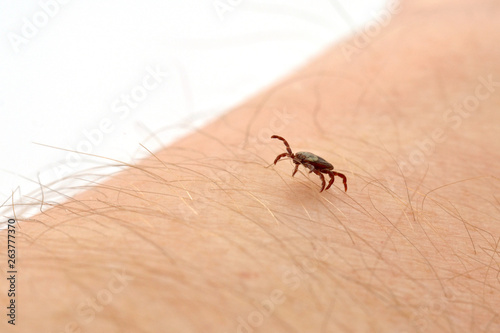 Insect mite on human skin.Parasite ,bloodsucker.