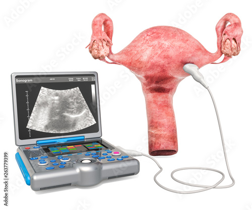 Ultrasonography of the uterus or transvaginal ultrasound concept. Uterus with medical ultrasound diagnostic machine, 3D rendering photo