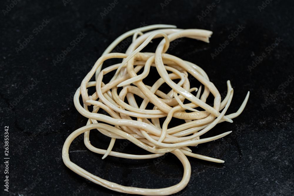 Ascariasis is a disease caused by the parasitic roundworm Ascaris lumbricoides for education in laboratories. Ascariasis is a disease caused by the parasitic roundworm Ascaris lumbricoides for education in laboratories.