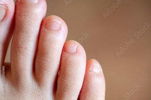 Men s toes  healthy toe nails