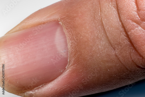 Finger nail index