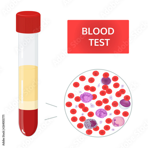 Medical vector concept: blood analysis in test tubes and composition of blood under microscope. Red and white blood cells, platelets image.