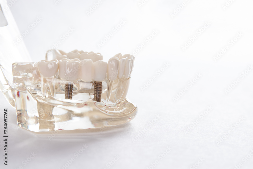 Artificial teeth on a white background with copy space, close-up