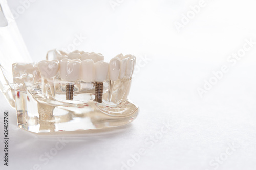 Artificial teeth on a white background with copy space, close-up